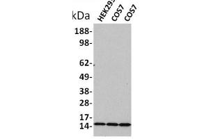 Western blot analysis of extracts of various celllines,using Acetyl-Histone H3 (Lys18) Antibody.