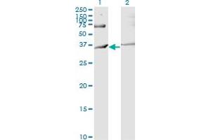 Western Blot analysis of RNF144B expression in transfected 293T cell line by IBRDC2 monoclonal antibody (M02), clone 4F1.