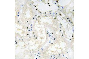 Immunohistochemical analysis of NR2F2 staining in human kidney formalin fixed paraffin embedded tissue section. (NR2F2 anticorps  (N-Term))