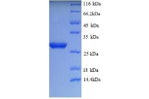 Ubiquitin Carboxyl-terminal Esterase L1 (Ubiquitin Thiolesterase) (UCHL1) (AA 1-222), (partial) protein (His tag)