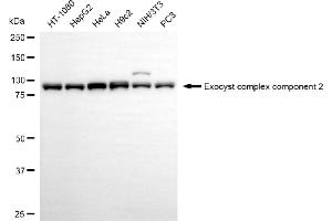 Western blotting analysis using exocyst complex component 2 antibody (ABIN7798542).
