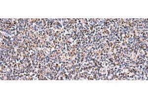 Immunohistochemistry of paraffin-embedded Human tonsil tissue using HSF2BP Polyclonal Antibody at dilution of 1:30(x200) (HSF2BP anticorps)