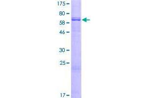 Image no. 1 for Diacylglycerol O-Acyltransferase 2 (DGAT2) (AA 1-388) protein (GST tag) (ABIN1351490)