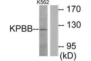 Western blot analysis of extracts from K562 cells, using KPBB Antibody. (PHKB anticorps  (AA 661-710))