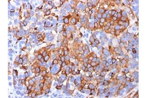 Image no. 1 for anti-Melan A (MLANA) antibody (ABIN6173195) (MLANA anticorps)