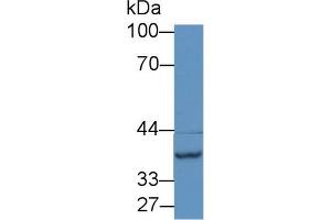 Detection of NAT2 in Mouse Liver lysate using Polyclonal Antibody to N-Acetyltransferase 2 (NAT2) (NAT2 anticorps  (AA 20-280))