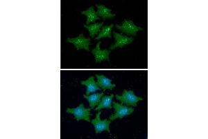 ICC/IF analysis of FKBP14 in HeLa cells line, stained with DAPI (Blue) for nucleus staining and monoclonal anti-human FKBP14 antibody (1:100) with goat anti-mouse IgG-Alexa fluor 488 conjugate (Green).