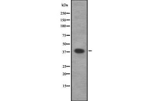 Western blot analysis of CAMK1 using Jurkat whole  lysates. (CAMK1 anticorps  (Internal Region))