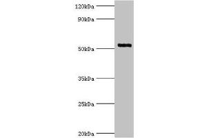 Western blot All lanes: Interleukin-1 receptor-associated kinase 4 antibody at 4 μg/mL + Jurkat whole cell lysate Secondary Goat polyclonal to rabbit IgG at 1/10000 dilution Predicted band size: 52, 38 kDa Observed band size: 52 kDa