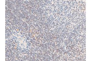 ABIN6267285 at 1/100 staining mouse spleen tissue sections by IHC-P. (ErbB2/Her2 anticorps  (pTyr1112))