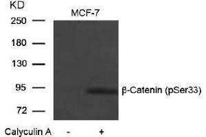 Image no. 1 for anti-Catenin (Cadherin-Associated Protein), beta 1, 88kDa (CTNNB1) (pSer33) antibody (ABIN196956) (CTNNB1 anticorps  (pSer33))