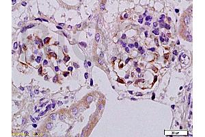 Formalin-fixed and paraffin embedded rat kidney tissue with Anti-Megsin Polyclonal Antibody, Unconjugated (ABIN728548) at 1:200, followed by conjugation to the secondary antibody and DAB staining (SERPINB7 anticorps  (AA 301-380))