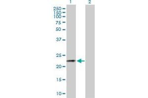 Western Blot analysis of CSN3 expression in transfected 293T cell line by CSN3 MaxPab polyclonal antibody. (CSN3 anticorps  (AA 1-182))