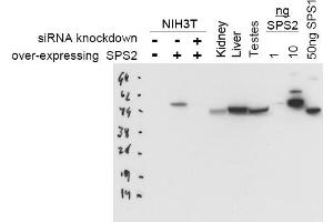 Image no. 1 for anti-Selenophosphate Synthetase 2 (SEPHS2) antibody (ABIN401044) (SEPHS2 anticorps)