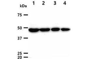 The cell lysates (40ug) were resolved by SDS-PAGE, transferred to PVDF membrane and probed with anti-human TUBG1 antibody (1:1000). (TUBG1 anticorps)