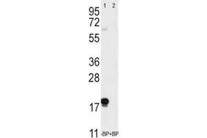 Western blot analysis of Thy1 antibody pre-incubated without (Lane 1) and with (2) blocking peptide in T47D lysate