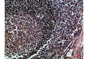 Immunohistochemical analysis of paraffin-embedded Human-tonsil, antibody was diluted at 1:100