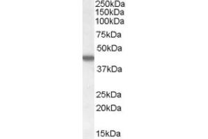 Image no. 1 for anti-Casein Kinase 1, epsilon (CSNK1E) (C-Term) antibody (ABIN374929) (CK1 epsilon anticorps  (C-Term))