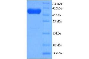 SDS-PAGE (SDS) image for D-2-Hydroxyglutarate Dehydrogenase (D2HGDH) (AA 56-533) protein (His tag) (ABIN5714248) (D2HGDH Protein (AA 56-533) (His tag))