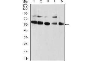 Western blot analysis using CBX2 mouse mAb against HUVEC (1), HEK293 (2), Hela (3), NIH/3T3 (4), and A431 (5) cell lysate.