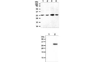 The cell lysates (40ug) were resolved by SDS-PAGE, transferred to PVDF membrane and probed with anti-human OSTF1 antibody (1:1000). (OSTF1 anticorps)