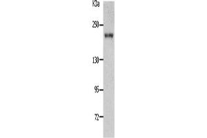 Western Blotting (WB) image for anti-Nephrosis 1, Congenital, Finnish Type (Nephrin) (NPHS1) antibody (ABIN2431713) (Nephrin anticorps)
