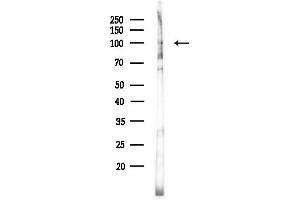 Western blot analysis of lysates from COLO205 cells(UV,30 min treatment), using MSK2 Antibody at 1/1000 dilution.