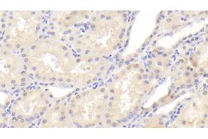 Detection of PCNT in Human Kidney Tissue using Polyclonal Antibody to Pericentrin (PCNT) (PCNT anticorps  (AA 2987-3246))