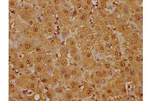 IHC image of ABIN7127533 diluted at 1:125 and staining in paraffin-embedded human liver tissue performed on a Leica BondTM system. (Recombinant GSTO1 anticorps)