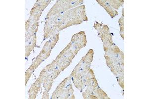 Immunohistochemistry of paraffin-embedded mouse heart using ATAD3B antibody at dilution of 1:100 (x40 lens). (ATAD3B anticorps)