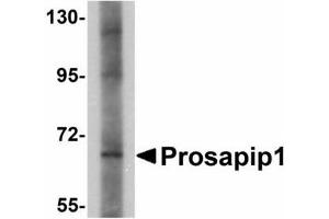 Image no. 1 for anti-ProSAP-Interacting Protein 1 (PROSAPIP1) (C-Term) antibody (ABIN478164) (ProSAPiP1 anticorps  (C-Term))