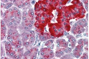 Human Pancreas (formalin-fixed, paraffin-embedded) stained with PAX4 antibody ABIN462174 followed by biotinylated goat anti-rabbit IgG secondary antibody ABIN481713, alkaline phosphatase-streptavidin and chromogen.