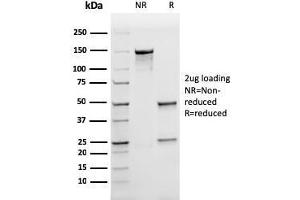 SDS-PAGE Analysis Purified Ferritin LC Recombinant Mouse Monoclonal Antibody (rFTL/1388).