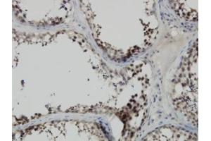 Image no. 1 for anti-PDZ Binding Kinase (PBK) (AA 1-110) antibody (ABIN599274) (PBK anticorps  (AA 1-110))