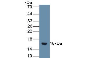 Western blot analysis of the recombinant protein. (SFRP5 anticorps  (AA 48-161))