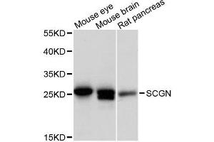 Western blot analysis of extracts of various cell lines, using SCGN antibody. (SCGN anticorps  (AA 1-276))