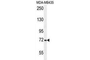 ARHGAP10 Antibody (Center) western blot analysis in MDA-MB435 cell line lysates (35µg/lane). (ARHGAP10 anticorps  (Middle Region))