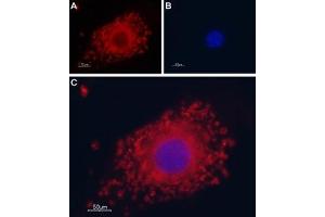 Expression of TRPP1 (PKD2) in C2C12 cell lineImmunocytochemical staining of TRPP1 (PKD2) in mouse paraformaldehyde-fixed and permeabilized muscle myoblasts (C2C12) cell line.