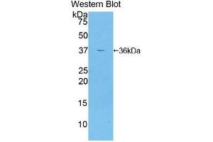Detection of Recombinant GAD2, Human using Polyclonal Antibody to Glutamate Decarboxylase 2 (GAD2) (GAD65 anticorps  (AA 65-105))