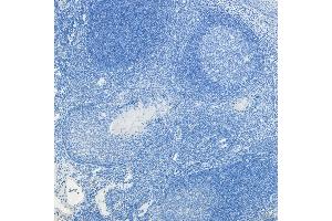 (ABIN5539622) Negative Control showing staining of paraffin embedded Human Tonsil, with no primary antibody. (c-FOS anticorps  (AA 283-295))