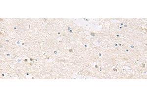 Immunohistochemistry of paraffin-embedded Human brain tissue using ANKS6 Polyclonal Antibody at dilution of 1:55(x200) (ANKS6 anticorps)