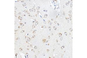 Immunohistochemistry of paraffin-embedded mouse brain using [KO Validated] SCD Rabbit pAb (ABIN7270589) at dilution of 1:100 (40x lens). (SCD anticorps  (C-Term))