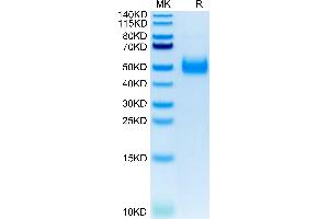 Human IL-17RB on Tris-Bis PAGE under reduced condition. (IL17 Receptor B Protein (AA 18-292) (His tag))