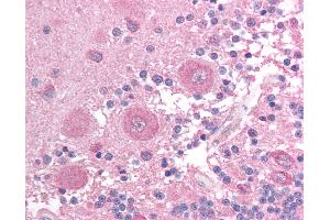 Anti-BCL2L14 / Bcl G antibody IHC of human brain, cerebellum. (BCL2L14 / BCL-G (C-Term) anticorps)