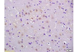 Formalin-fixed and paraffin embedded rat brain labeled with Anti-phospho-P53(Ser20) Polyclonal Antibody, Unconjugated (ABIN702895) at 1:200 followed by conjugation to the secondary antibody and DAB staining.