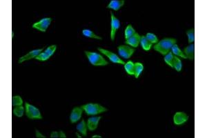 Immunofluorescence staining of Hela cells with ABIN7142520 at 1:100, counter-stained with DAPI. (RPS23 anticorps  (AA 2-143))