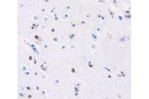 Used in DAB staining on fromalin fixed paraffin- embedded Kidney tissue