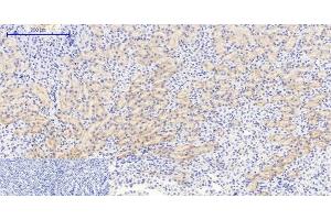 Immunohistochemistry of paraffin-embedded Mouse kidney tissue using Phospho-IkB alpha (Ser32/S36) Polyclonal Antibody at dilution of 1:200 (NFKBIA anticorps  (pSer32, pSer36))