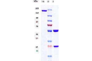 Anti-IFNg Reference Antibody (fontolizumab) on SDS-PAGE under reducing (R) condition. (Recombinant IFNG (Fontolizumab Biosimilar) anticorps)