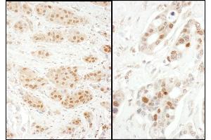 Immunohistochemistry (IHC) image for anti-Exportin 5 (XPO5) (AA 1154-1204) antibody (ABIN7454998)